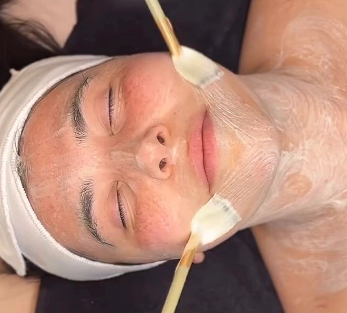 luxury facials, great results non invasive skin rejuvenation, enzyme exfoliation, wrinkles, dark spots