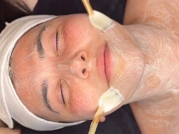 luxury facials, great results non invasive skin rejuvenation,enzyme exfoliation, wrinkles,dark spots