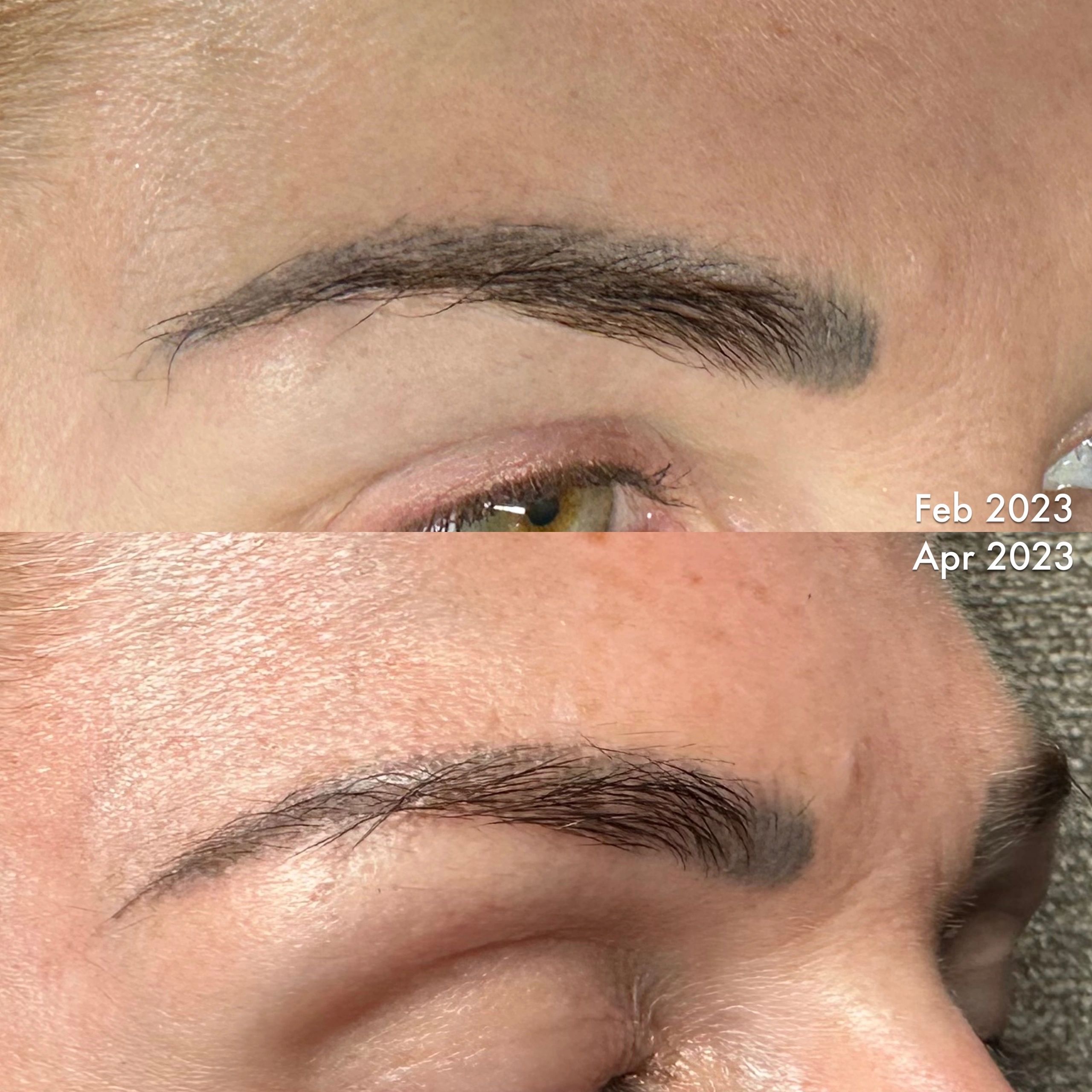Lightening/Removal