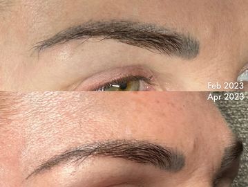 takes sessions, but has proven beneficial to anyone with: old pigment, bad shapes, discoloration 