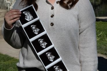 Person holding a series of ultrasound images outdoors.