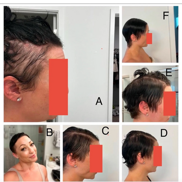 Pictures C-F are 1.5 weeks apart