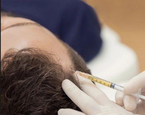 A person receiving a scalp injection for hair treatment.