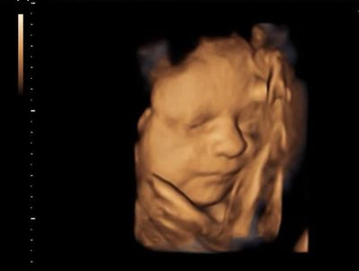 3d/4d scan
ultrasound pregnancy scan 
gender scan
early scan
pregnancy scan
private pregnancy scan