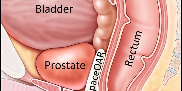 Docteur Caullery. Urologue a Frejus Saint raphael. Cancer de la prostate.