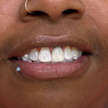 Tooth gems byOfficial Pro Smiles, book with us in Mesa Az 602.486.8629.