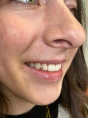 Lighten Up Teeth Whitening and Tooth Gems - Up To 36% Off - Mesa, AZ