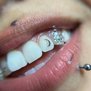 24k Gold tooth Moon jewelry  and chandelier design applied by Official Pro Smiles