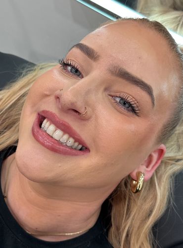 happy client after getting tooth gems placement on canine and lateral tooth in Mesa AZ