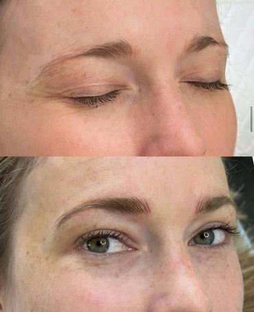 Before and after eyebrow enhancement showing fuller, defined brows.