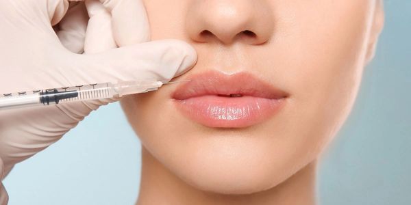 Lip Filler Injection