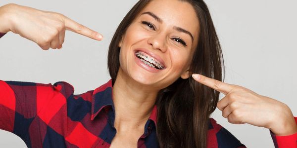 Braces para adultos