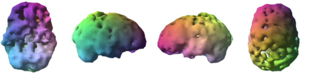UNHEALTHY BRAIN IMAGE