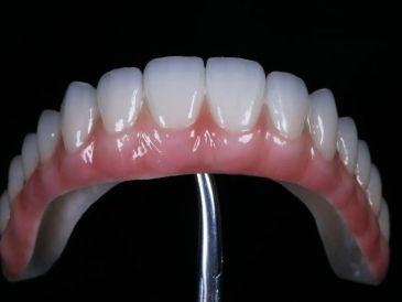 Set of artificial teeth with gums on a metal holder.