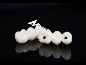 Dental crowns arranged in a row on a black reflective surface.