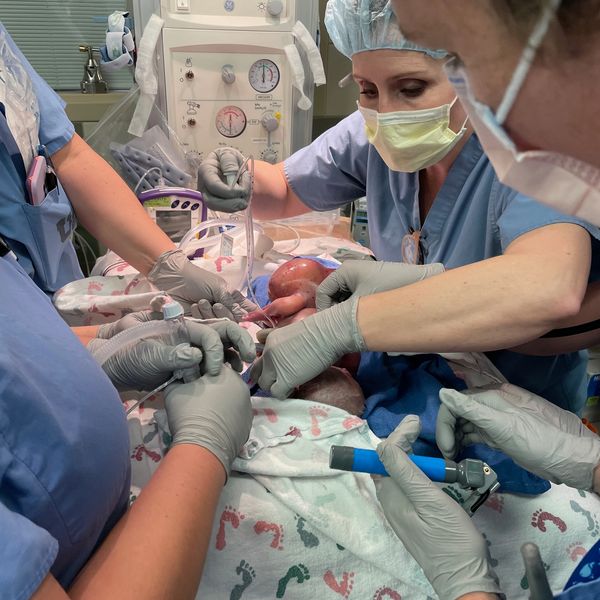 Multidisciplinary care treat treating a child with an SCT at Primary Childrens Hospital in Utah