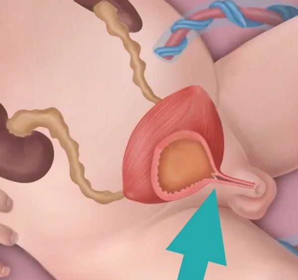 Illustration of female reproductive system focusing on the uterus and cervix.