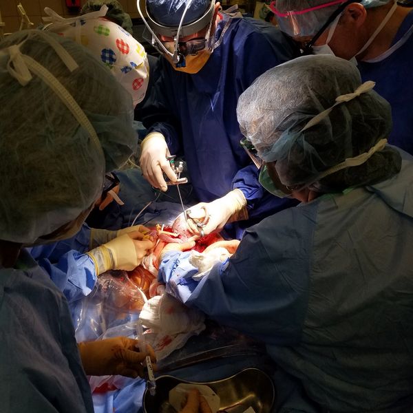 Multidisciplinary care team performing fetal surgery at the Grant Scott Bonham Fetal Center in Utah