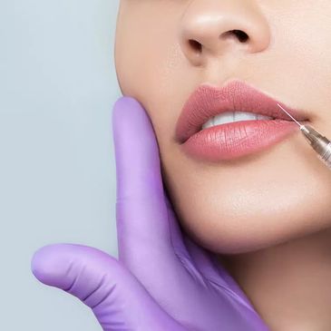 Close-up of lip injection procedure with a syringe and purple gloves.