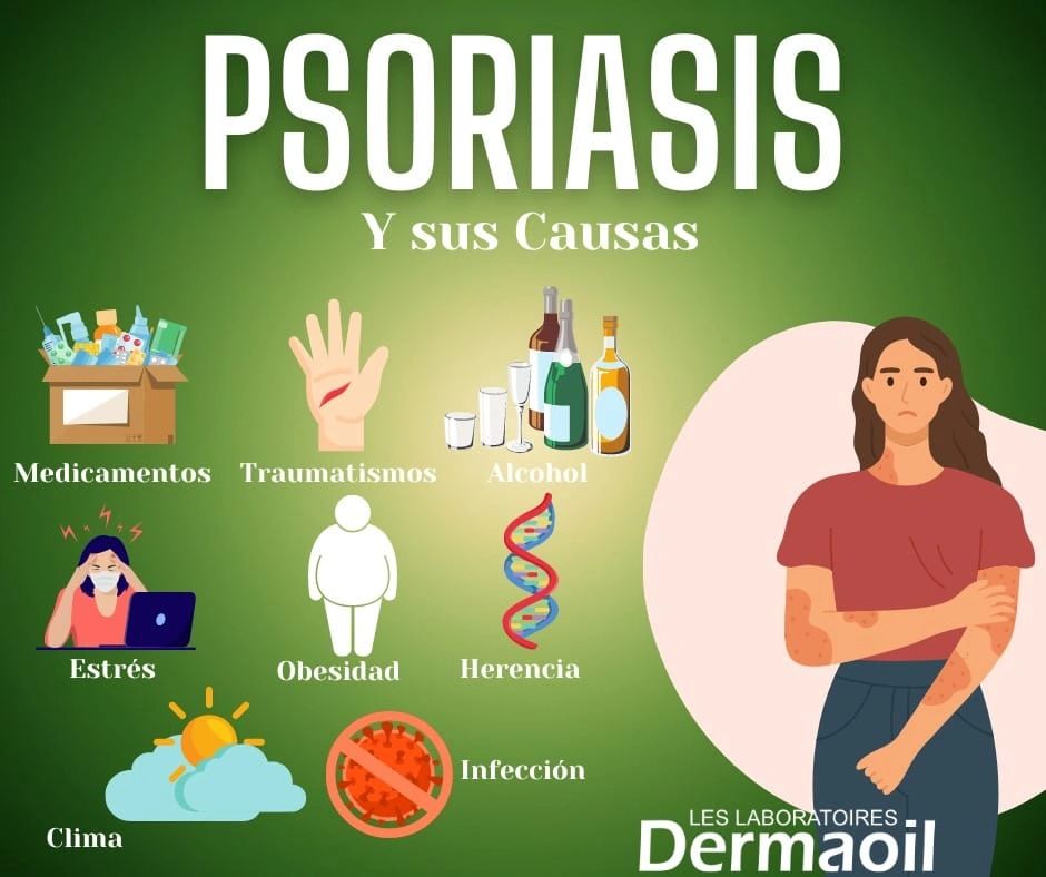 PSORIASIS Y SUS CAUSAS