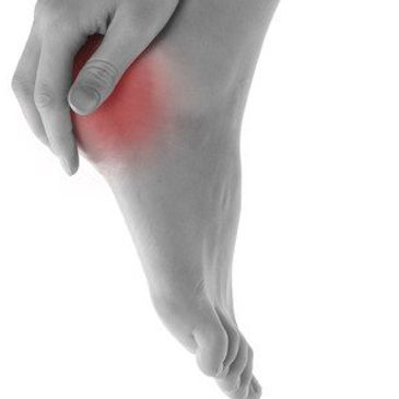 plantar fasciitis, back pain, sciatica, balance, posture, balance