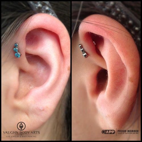 swollen cartilage piercing