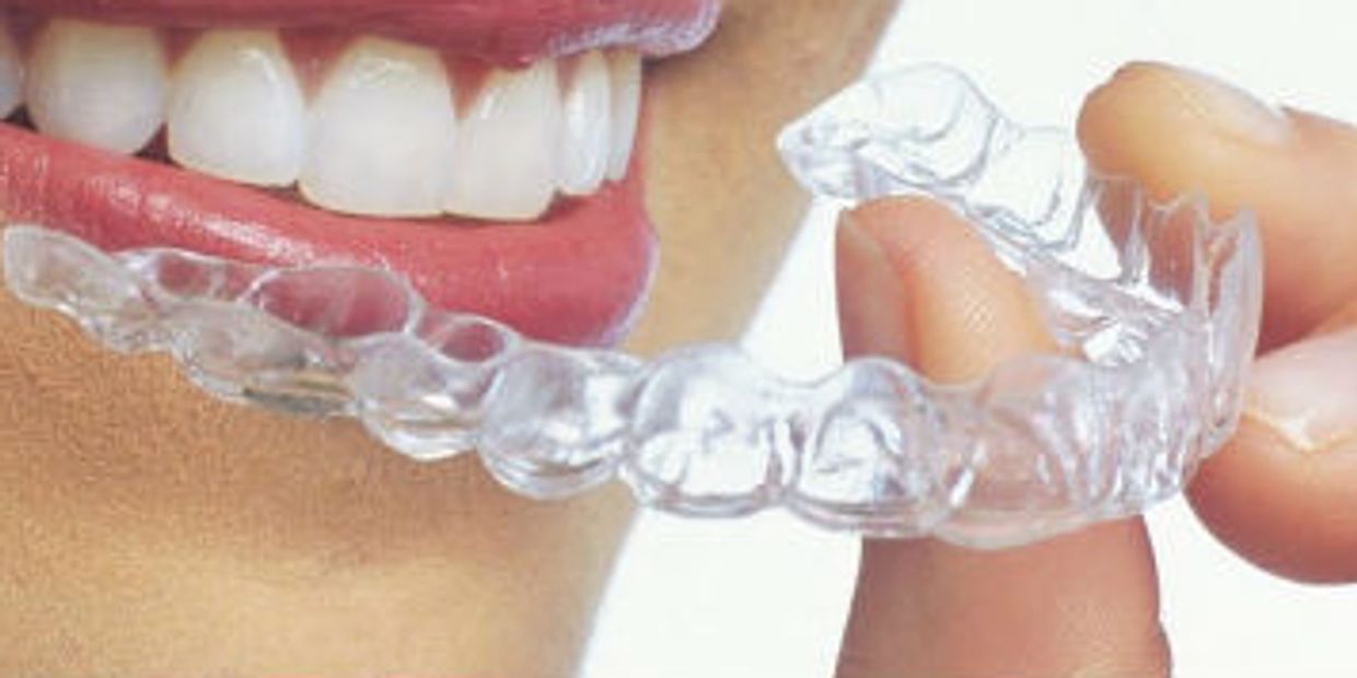 metal free holistic orthodontic dental healthy less time comfort healthy fast convenient low cost