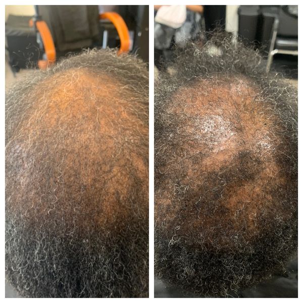 Head Of Mane Wynn Corporation