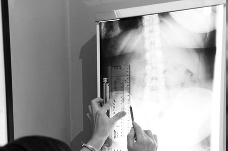 Report of Findings Chiropractic