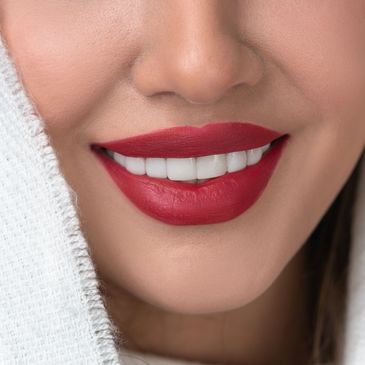 E.max Veneers Dubai | Natürliches Ergebnis einer Smile Makeover Behandlung in Dubai.