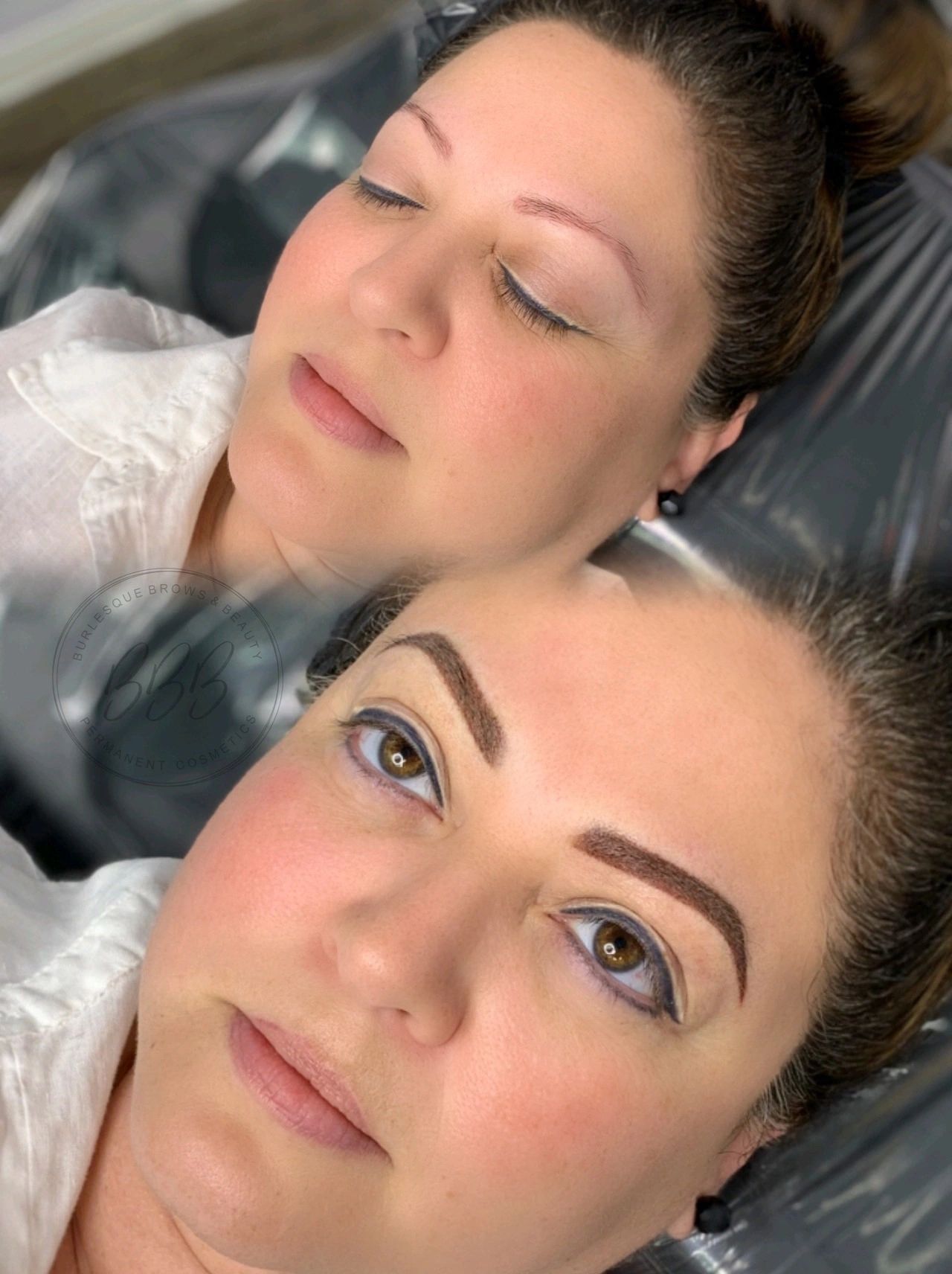 A picture of before and after the treatment of Brow correction 