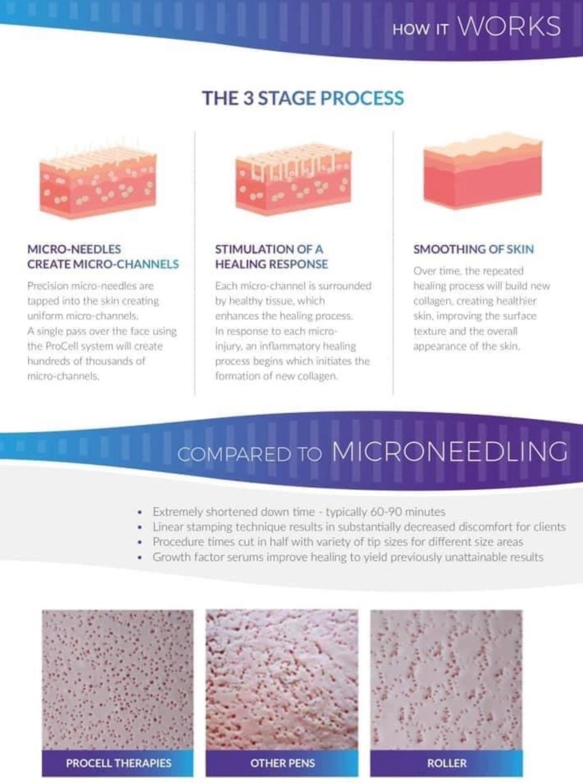 An infographic about microchanneling