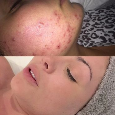 Skinsacred