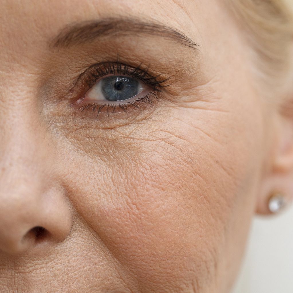 Wrinkles