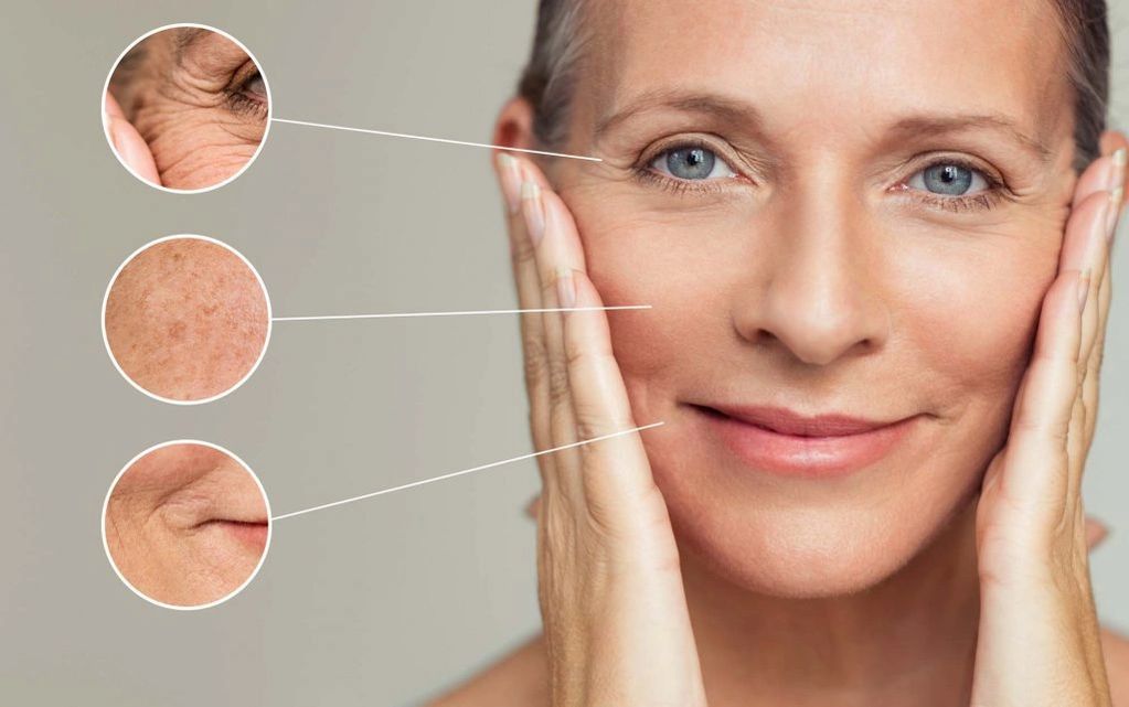 Fine Lines & Wrinkles