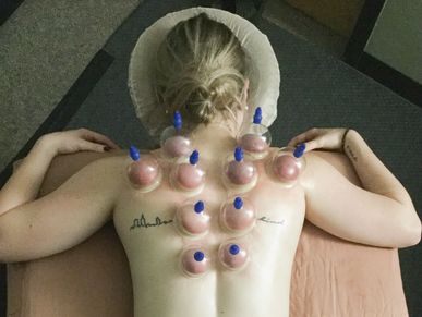 Cupping, detoxification, recovery.