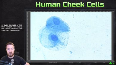 A screenshot of the video going over the human cheek cells.