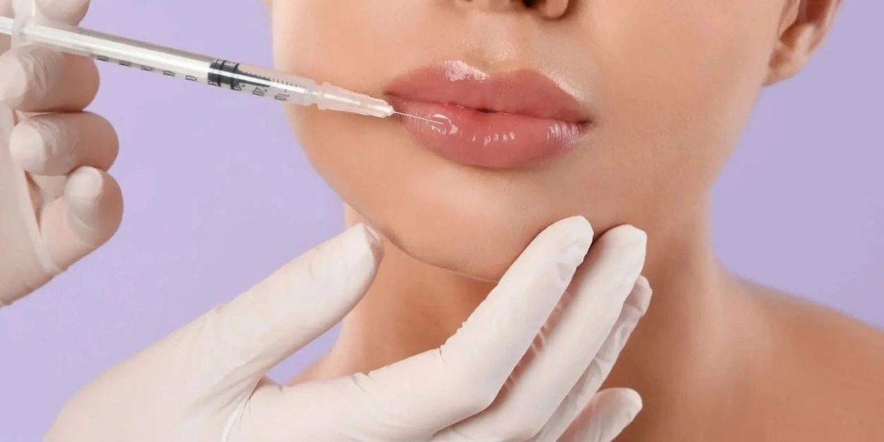 lip fillers
