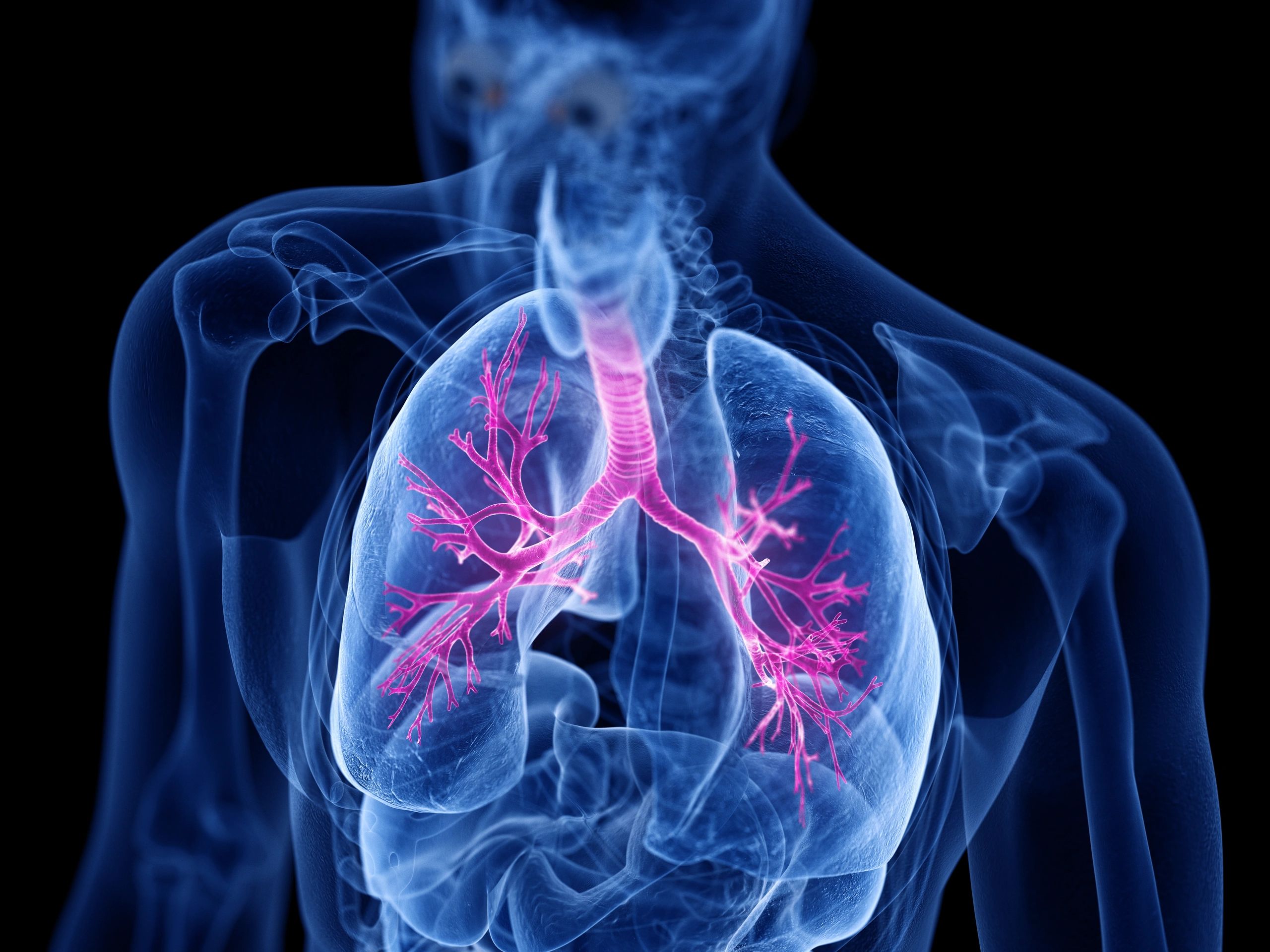 Hyperbaric Oxygen Therapy and its Role in Emphysema Management