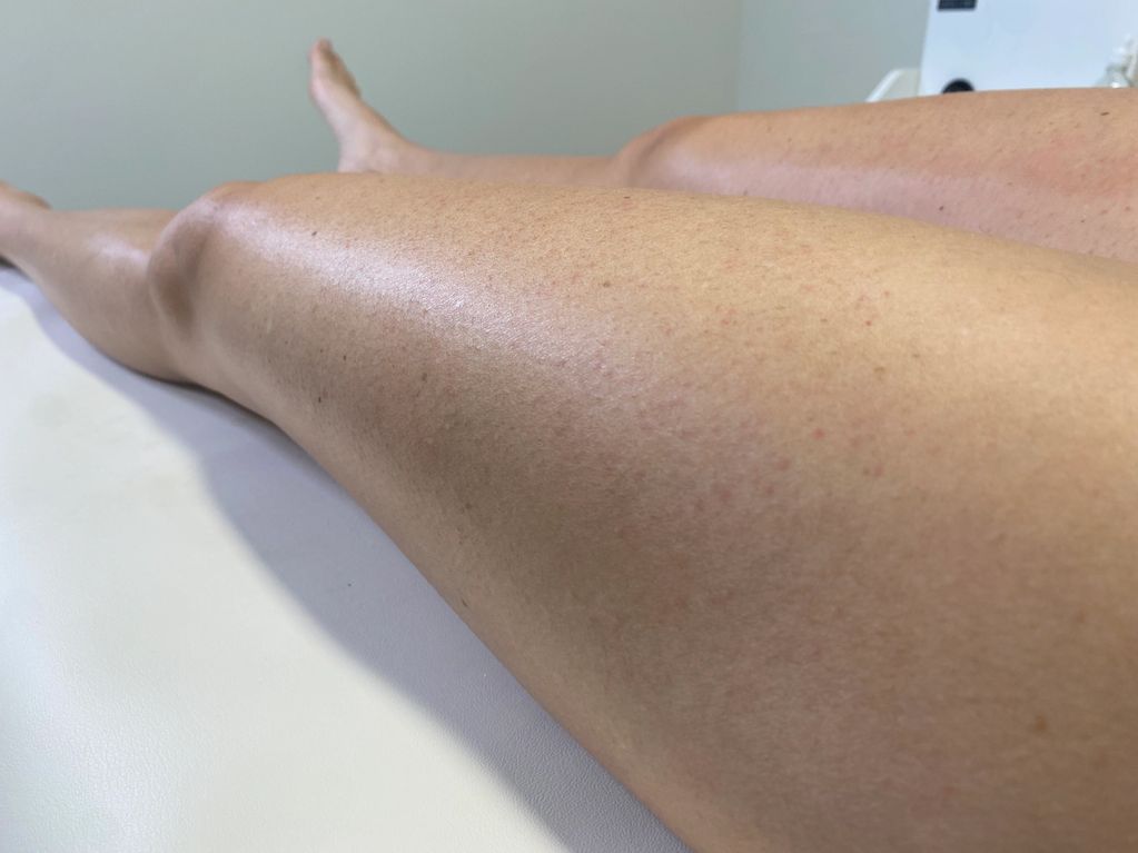 Full Leg Wax - Baby Smooth & Radiant 