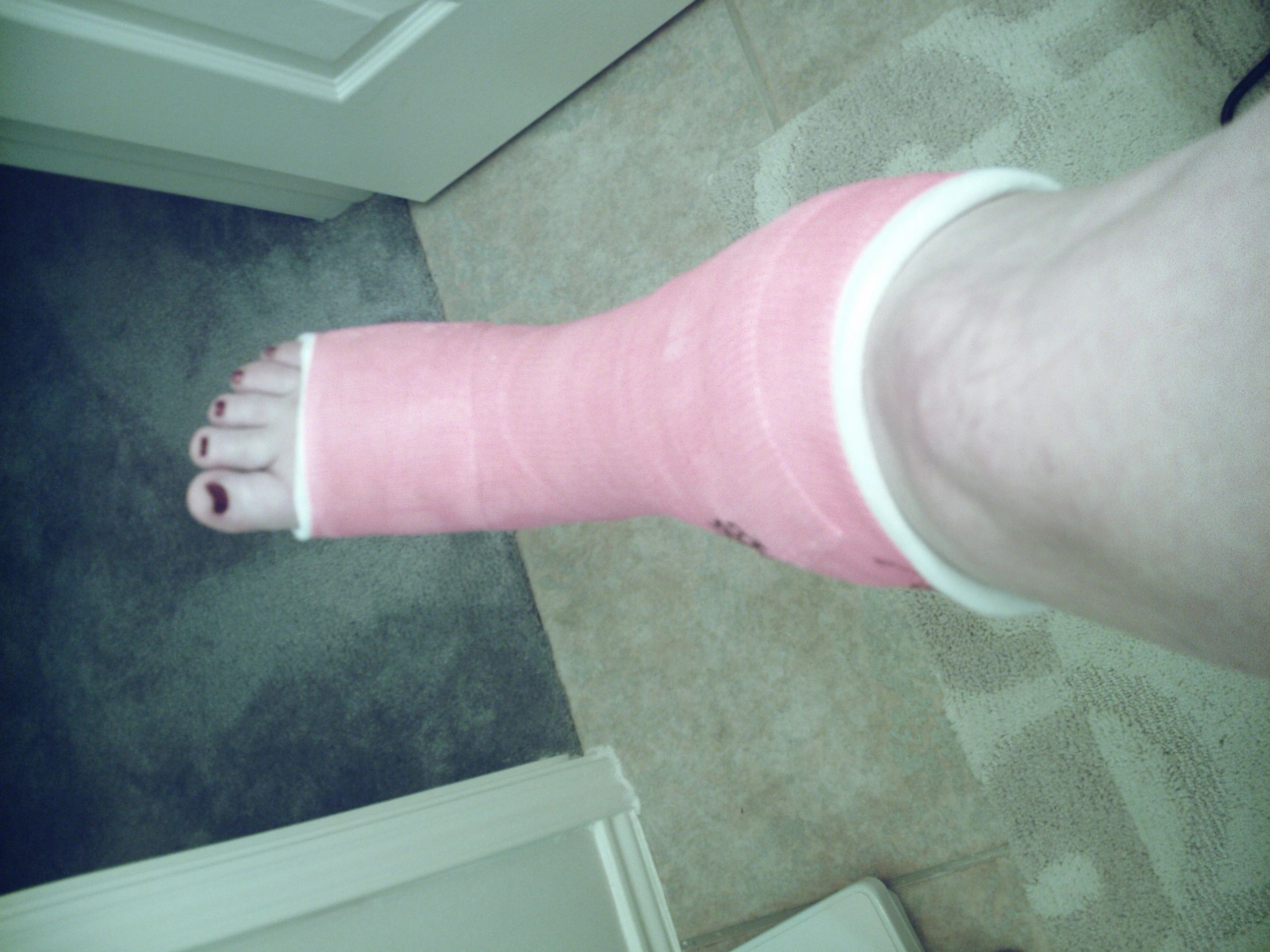 my_pink_cast.jpg