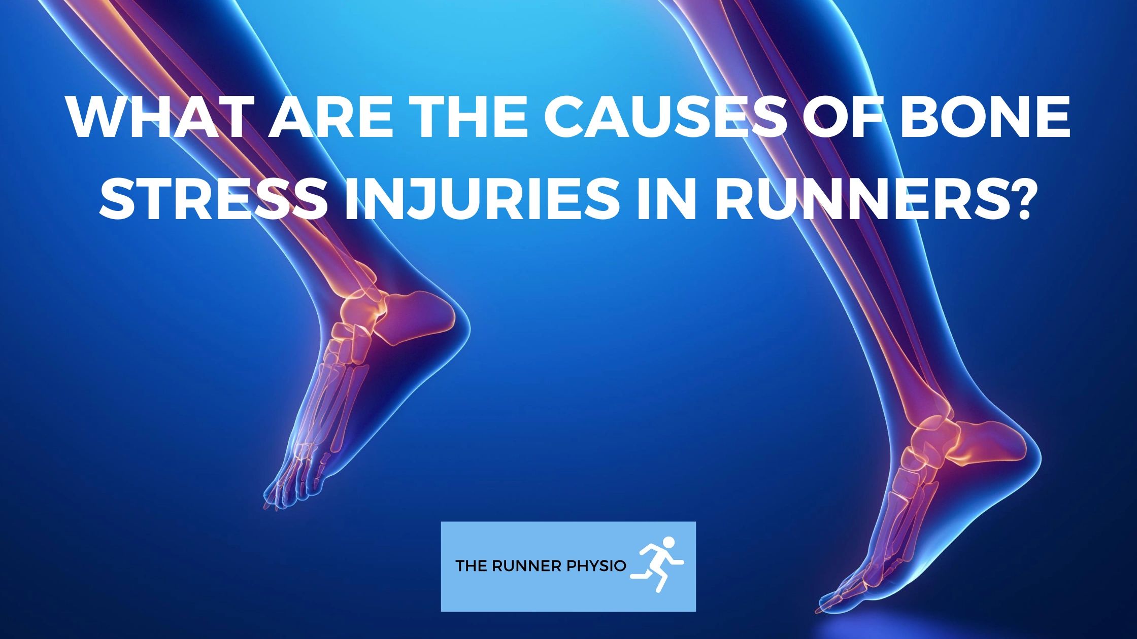 What are the Causes of Bone Stress Injuries in Runners?
