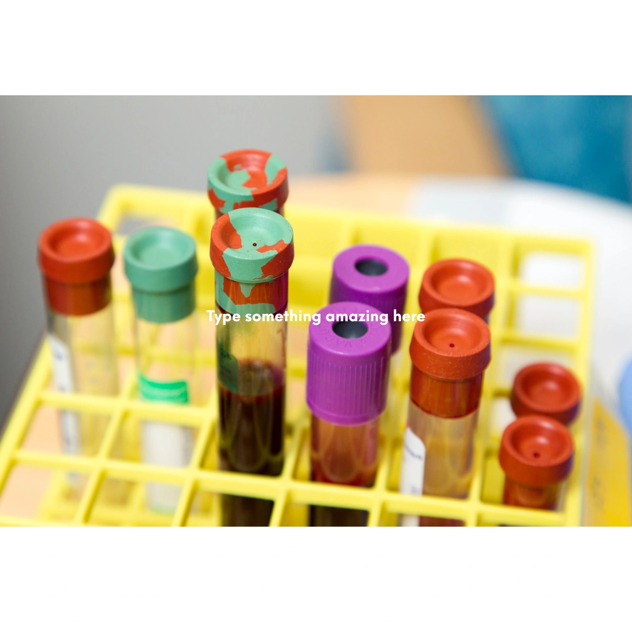 Mobile Phlebotomist Specimen Collection On the Road Labs