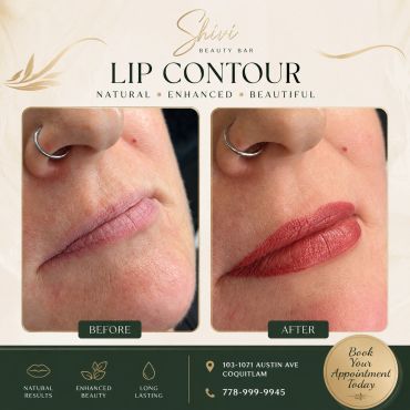 Lip contour before and after results at Shirin Beauty Bar.