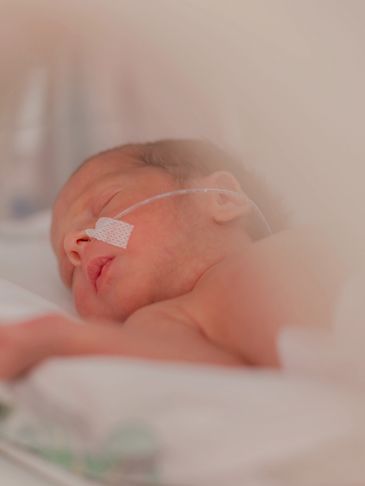 Newborn baby with a feeding tube resting peacefully.