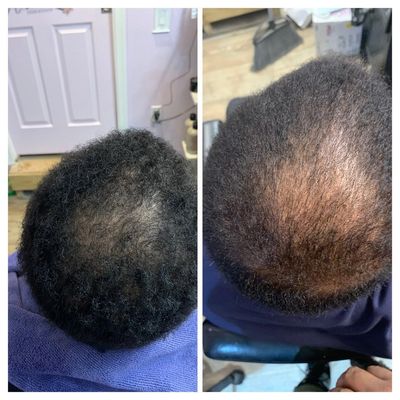 Rebelhairboutique - Hair Loss, Hair Growth, Alopecia | Rebelhairboutique Rebelhairboutique - Hair Loss, Hair Growth, Alopecia | Rebelhairboutique