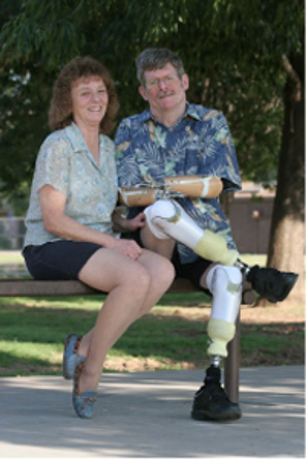 Jeff and Carol were married in the hospital shortly after the amputation surgeries that saved his li