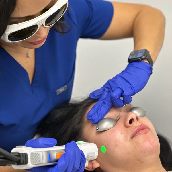 laser facials and pigment reduction