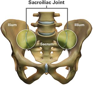 sacroiliac joint pain pregnancy