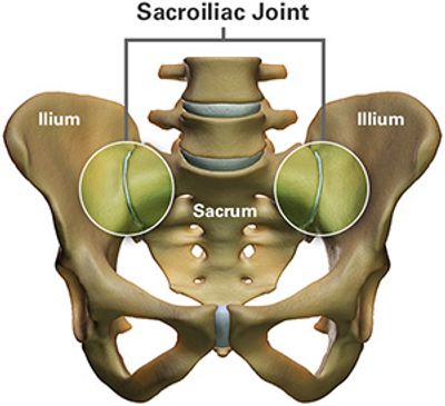 Exercise and Physical Therapy for Sacroiliac Joint Dysfunction